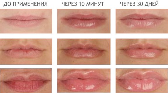 УВЕЛИЧИТЕЛЬ ГУБ LIP PLUMPER